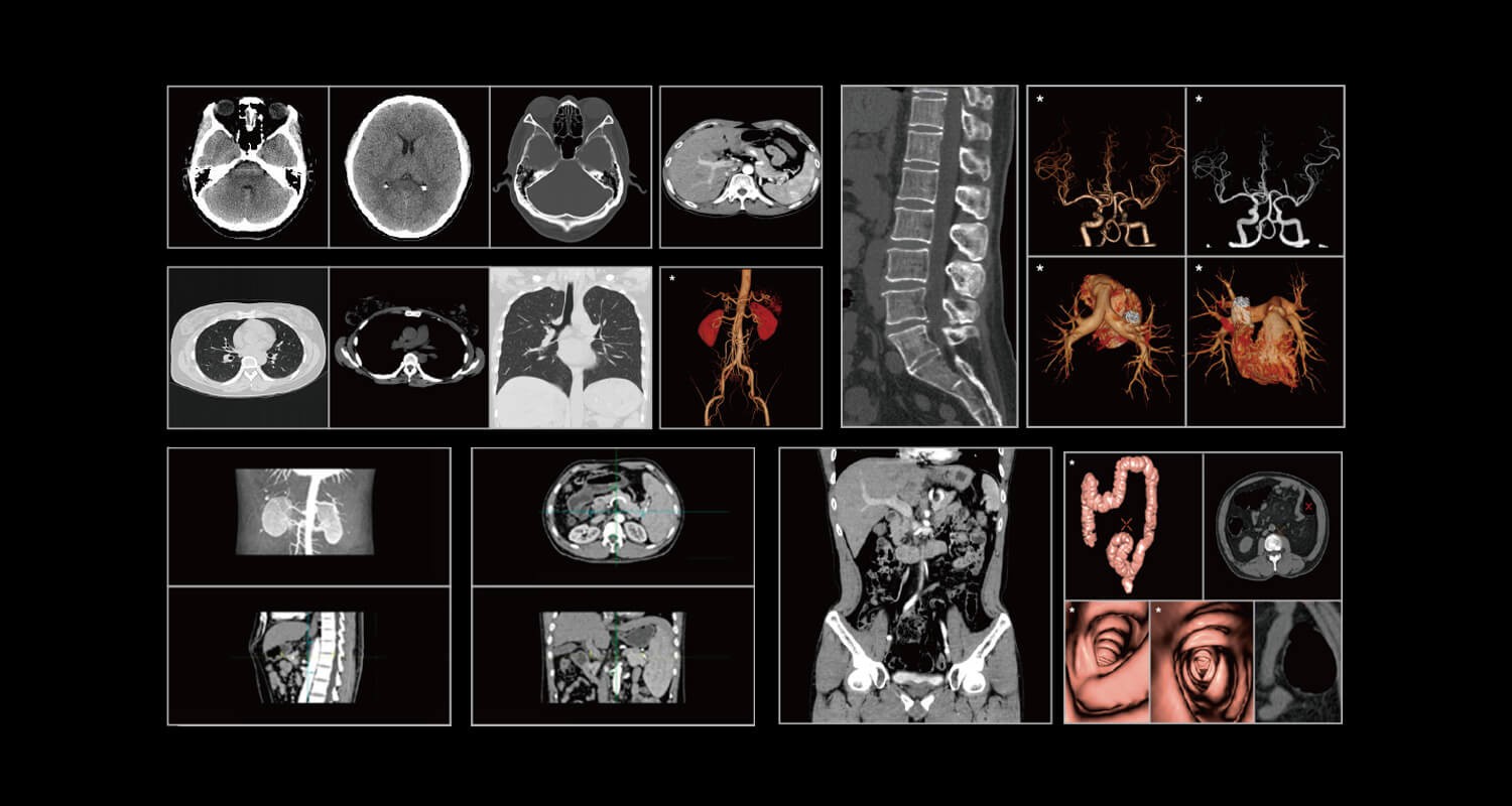 重卡型車載CT（智能移動(dòng)醫(yī)療車）